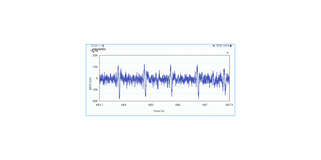 Neuranics Unleashes 24 7 Heart Monitoring Revolution At CES 2024 With A   11583 319648 1 Mcg Pic2 